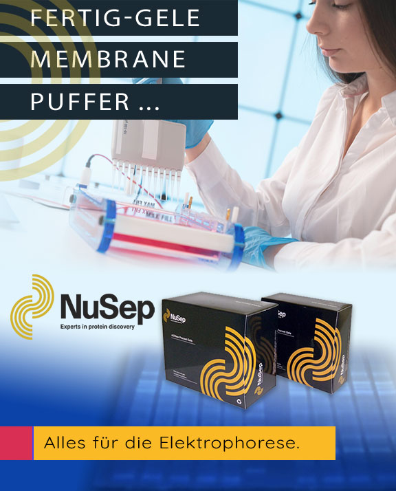 Fertig-Gele, Membrane und Puffer von NuSep